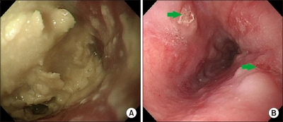 JCN_10_025_fig_1.jpg