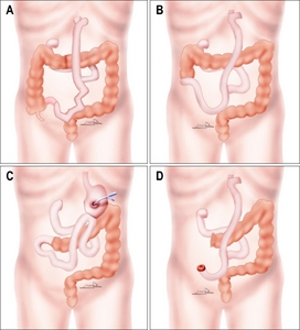 SMN_6_033_fig_1.jpg